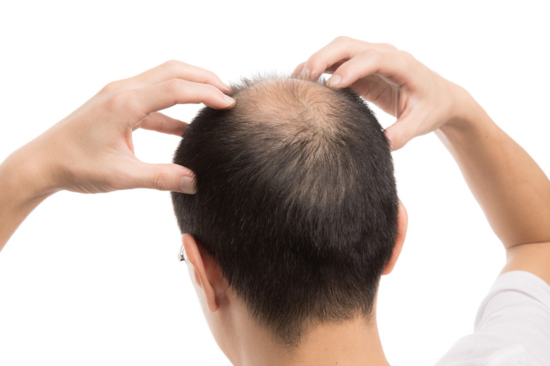 頭皮の乾燥による薄毛をセルフマッサージで対策する男性